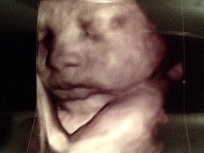 Jayden's 4D Sonogram